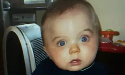 British Teen's Last Hope: £2.5m US Surgery for Ultra-Rare Condition