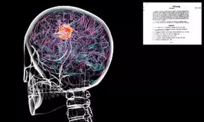 CIA Document Reveals 1950s Soviet Research Linking Parasites and Cancer Treatments