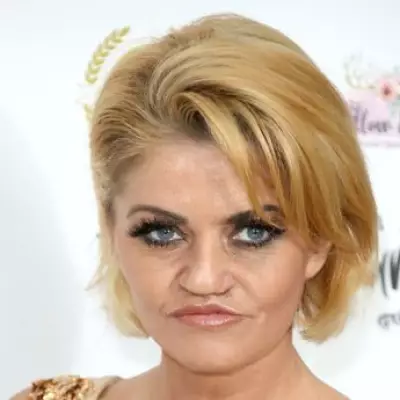 Danniella Westbrook 'Terrified' of Future Surgeries After Painful Facial Reconstruction