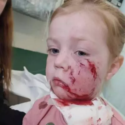 Four-Year-Old Girl's Life Changed Forever After Vicious Bulldog Attack
