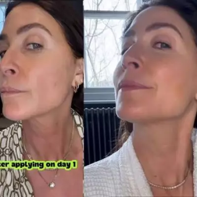 Lisa Snowdon's Neck Serum Praise: Smoother Skin in Two Weeks