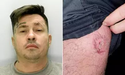 Police Officer Bitten During Arrest, Suspect Jailed for Assault