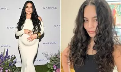 Vanessa Hudgens Reveals Postpartum Hair Loss Struggle After Second Child