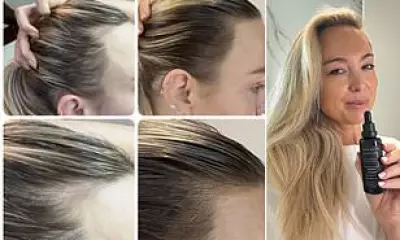 Vita-Growth Scalp Serum Returns to Australian Shelves After Sell-Outs