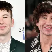 Barry Keoghan's Transformation: Expert Points to 'Subtle Aesthetic Treatments'