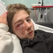 Boy, 12, 'Lucky to Be Alive' After Gang's Savage High Street Attack in Dundee