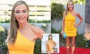 Denise Richards Reveals Full Facelift Journey in Candid Interview
