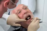 Dental Crisis Looms as UK's Elderly Keep More Natural Teeth