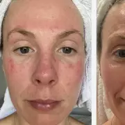 Dr Sam's Flawless Cleanser: The £20 'Holy Grail' Skincare Product Shoppers Adore