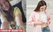 Groundbreaking Diabetes Trial Cures 10 Americans of Type 1 Condition