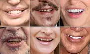 How Your Teeth Reveal Your True Age: Dentists Analyse Celebrity Smiles