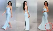 Kendall Jenner's Shoe Malfunction at Vanity Fair Oscar Party