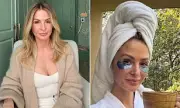 Millie Mackintosh Rates Her Cosmetic Tweakments from Botox to Boob Job