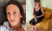 Miranda Hart Reveals Ankle Injury and Healthcare Anxiety in Candid Health Update