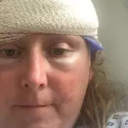 Mum's Menopause Symptoms Turned Out to Be 10 Brain Tumours