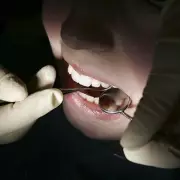 NHS Dental Fees to Rise by 1.7% Across England from April 2026