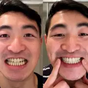 Smoker's Dentist Halts Stained Teeth Checks After 35p-a-Day Whitener Use