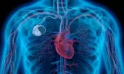 Watch-Sized Heart Implant Zaps Organ to Switch Fuel Source, Boosting Function