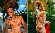 Winnie Harlow Sizzles in Vibrant Bikini While Promoting Sun Care Brand