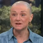 Woman Spends £20,000 on Hair-Pulling Habit Before Embracing Baldness