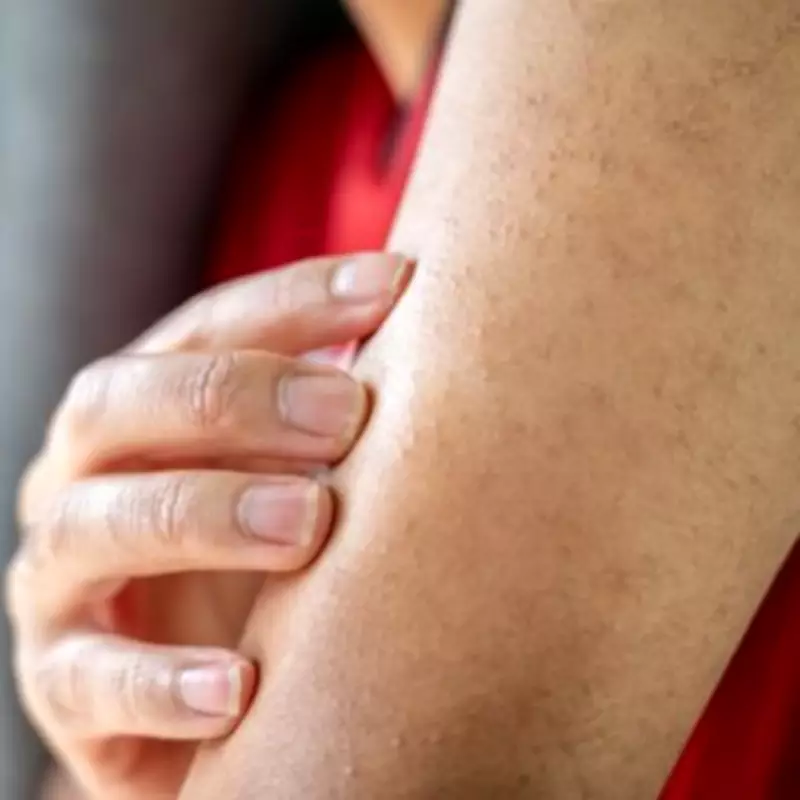 Banish Bumpy 'Chicken Skin' This Spring with Top-Rated Lotion on Sale