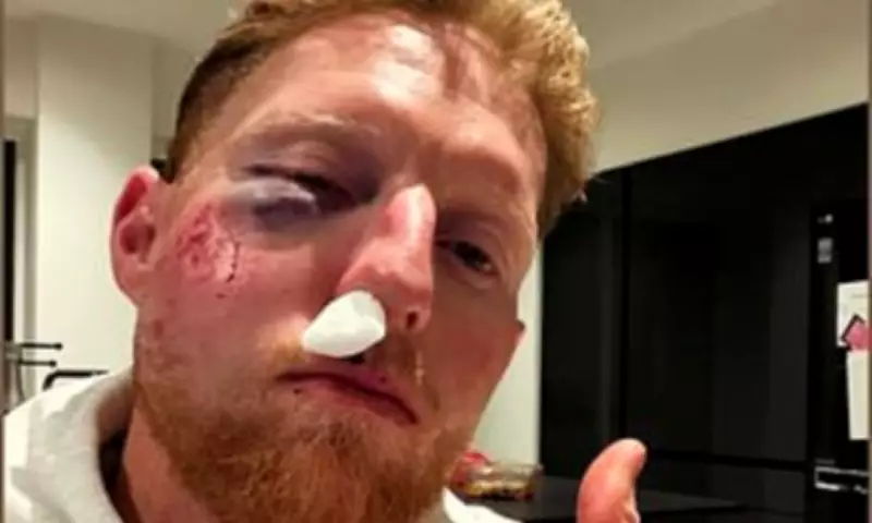 Ben Stokes Reveals He's 'Lucky to Be Alive' After Cheekbone Fracture