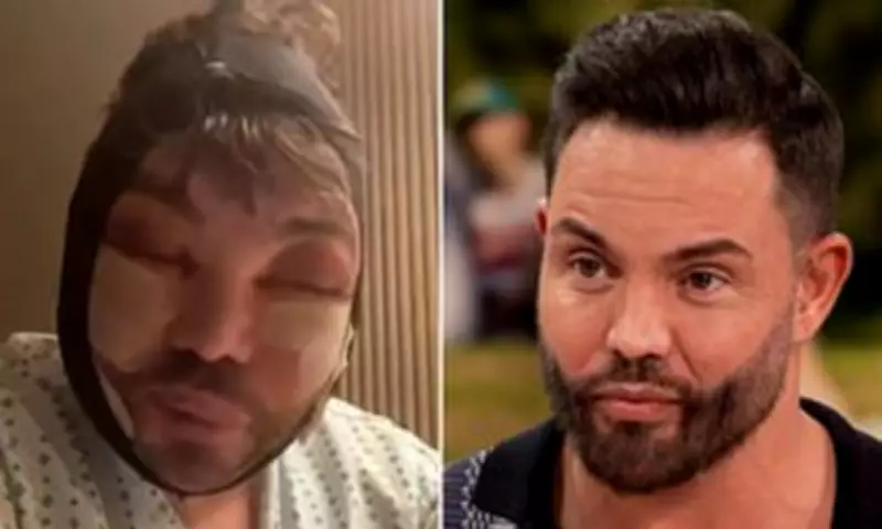 Bobby Norris Battles Insomnia Following Extensive Cosmetic Surgery Procedures