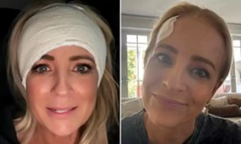 Carrie Bickmore Reveals Head Injury Cut Artery to Bone
