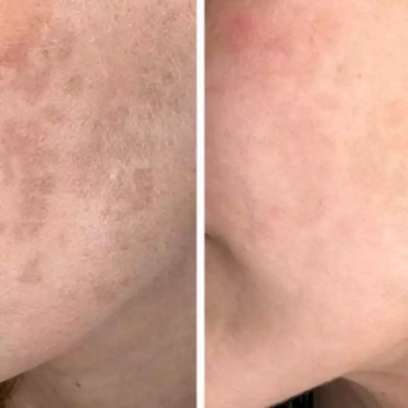 Dermatologist's New Serum Targets 'Zombie Cells' to Fade Dark Spots