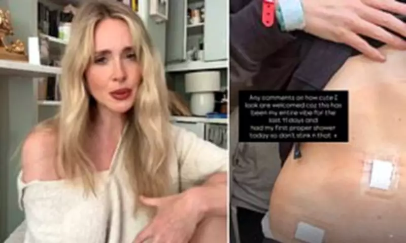 Diana Vickers Diagnosed with Pelvic Congestion Syndrome After Years of Pain
