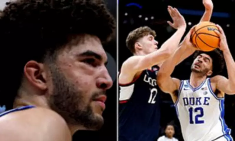 Duke's Cameron Boozer Reveals Facial Fractures After UConn March Madness Loss