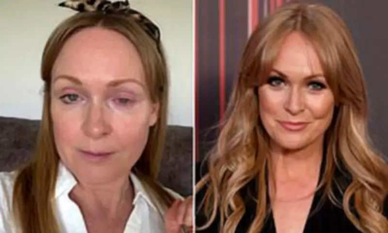 Emmerdale Star Michelle Hardwick Hospitalised with Eye Injury, Shares Recovery Journey