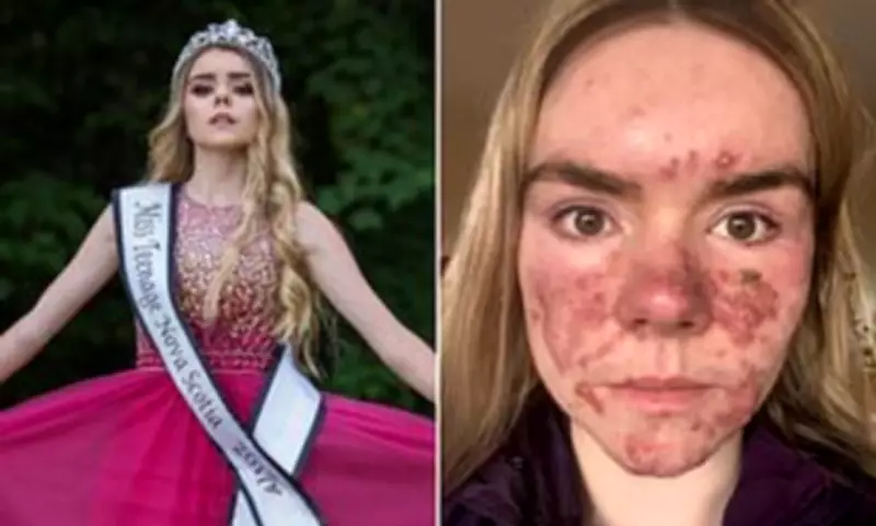 From Pageant Queen to Acne Warrior: Zoe Morgan's Journey of Self-Discovery