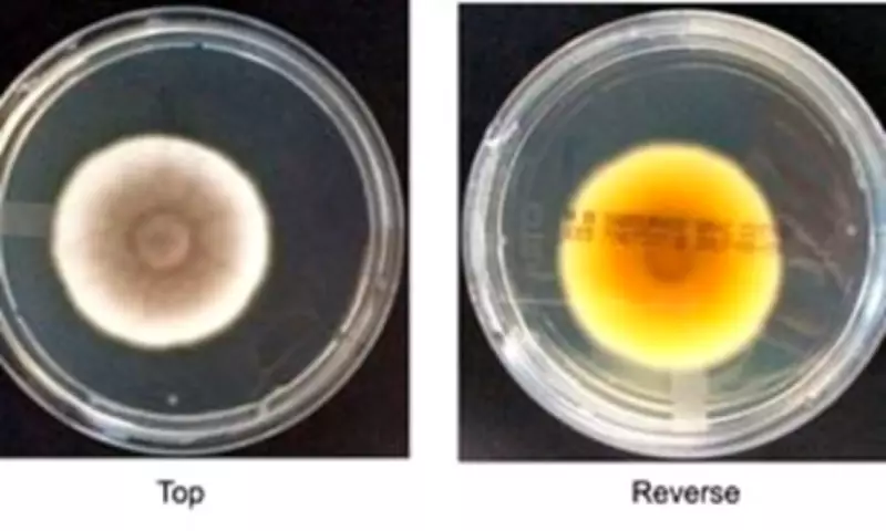 Fungal Pathogen Could Survive Journey to Mars, NASA Study Reveals