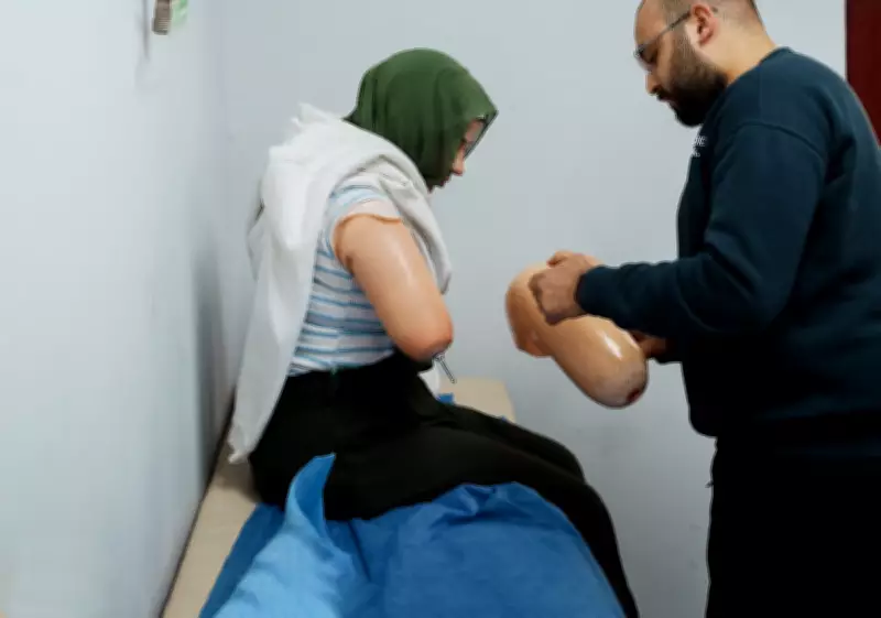 Gaza Amputees Face Legal Limbo in Egypt After Life-Changing Injuries