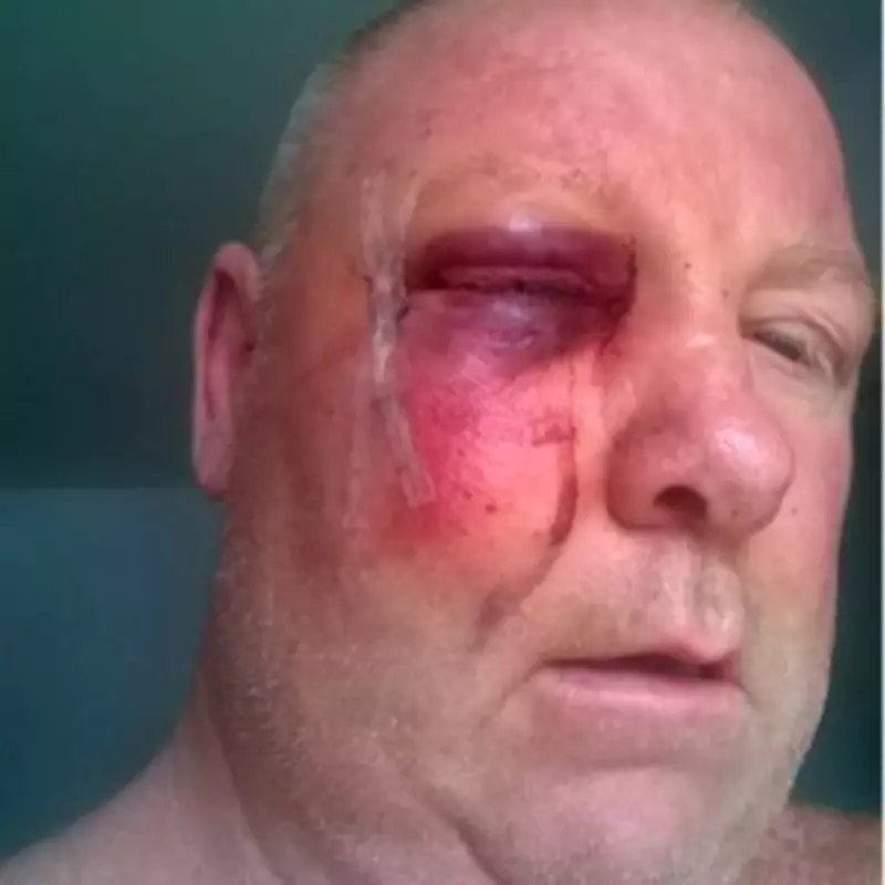 GMP Pays Five-Figure Sum After Man Suffers Fractured Eye Socket in Custody