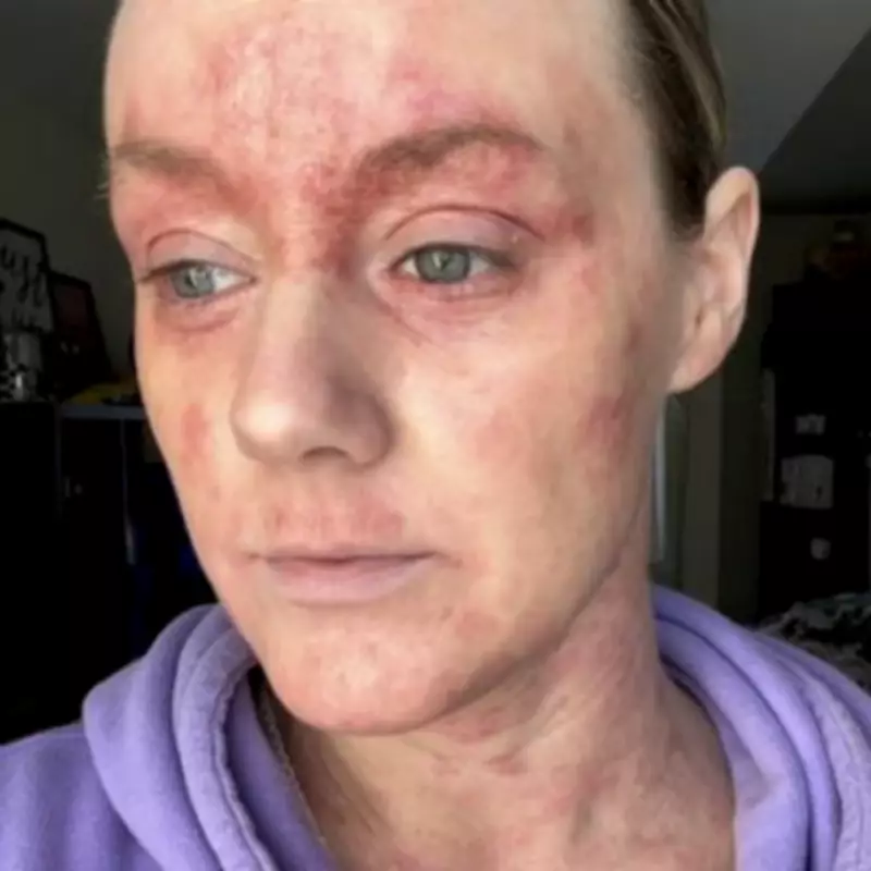 Hundreds Report Severe Skin Condition TSW as Medical Community Remains Baffled