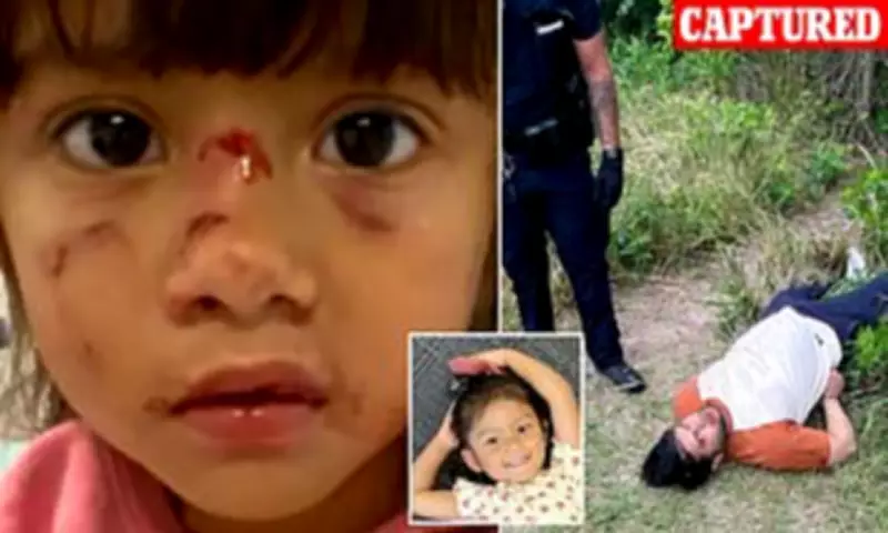 Illegal migrant bites 3-year-old girl's face, pulls out teeth in Texas park attack