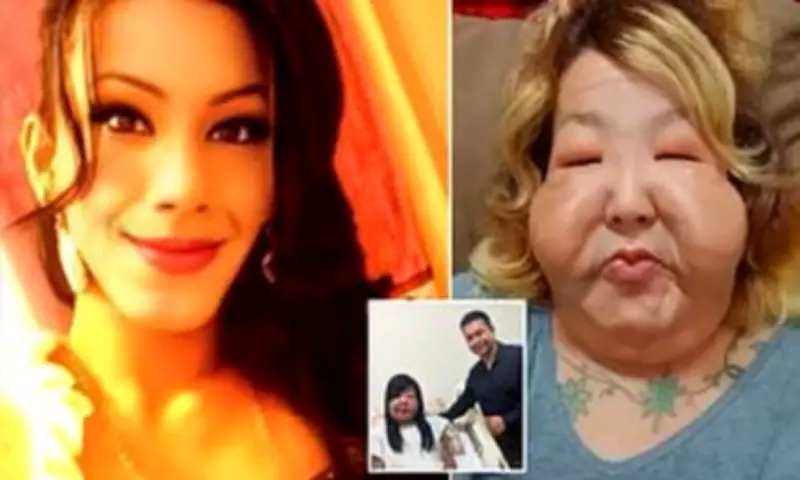 Influencer's Facial Reconstruction Paused for Breast Implant Surgery After Botched Fillers