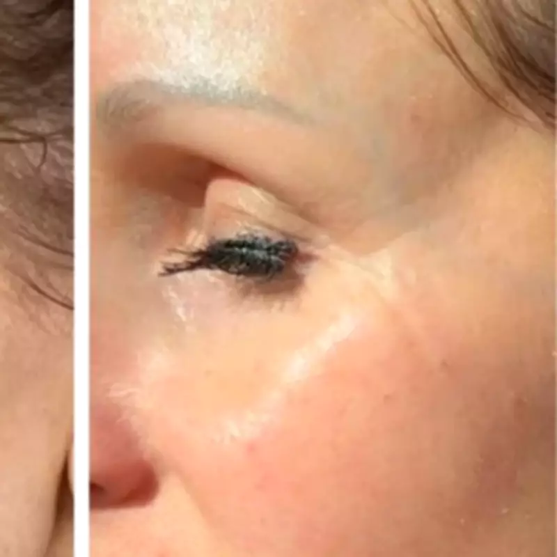 LED Face Mask with £219 Off Leaves Women Makeup-Free, Skin 'So Good'