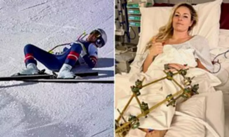 Lindsey Vonn Opens Up About Mental Health Battle After Olympic Crash