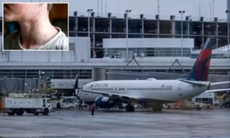 Measles Alert at Chicago O'Hare Airport: Health Officials Warn of Exposure Risk