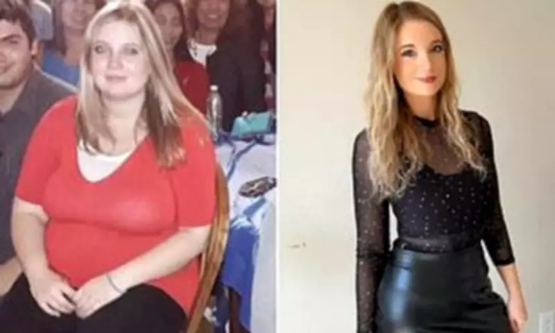 Mother's Weight Loss Struggle Reveals Incurable Lipoedema Condition