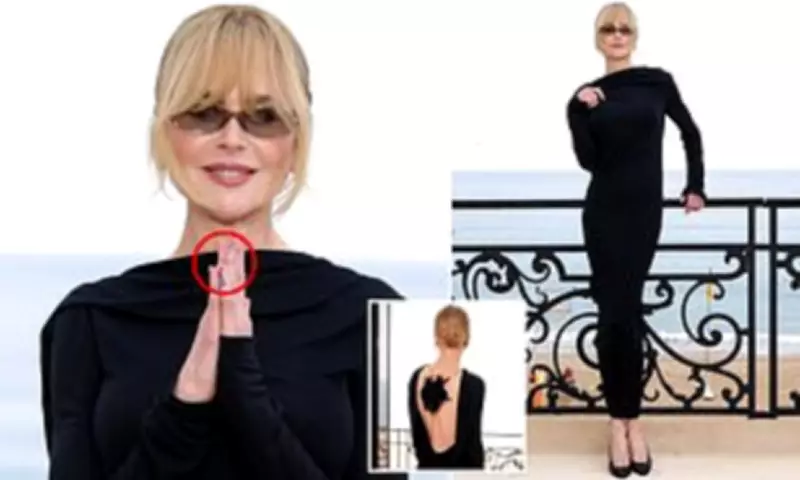 Nicole Kidman Raises Concerns with Bruised Fingers at Chanel Cruise Show