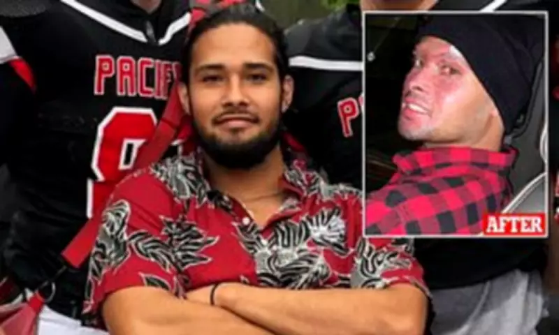 Oregon Man Loses Eight Fingers After Drug-Fueled Fire Incident, Sues Police