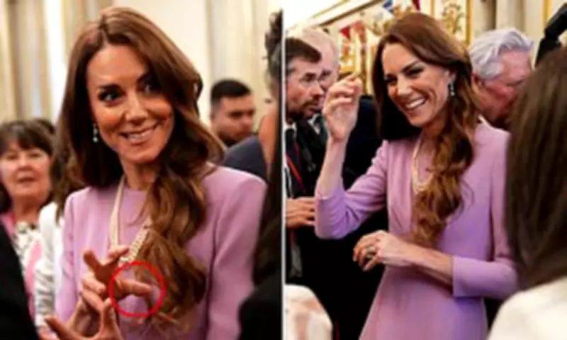 Princess Kate's Persistent Plasters: A Royal Hand Injury Pattern