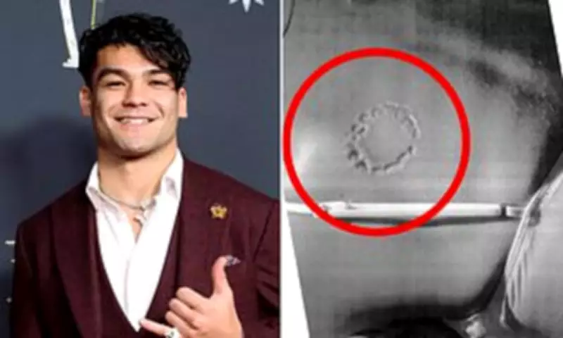 Rams Star Puka Nacua Served Lawsuit in Rehab Over NYE Biting and Antisemitism Claims