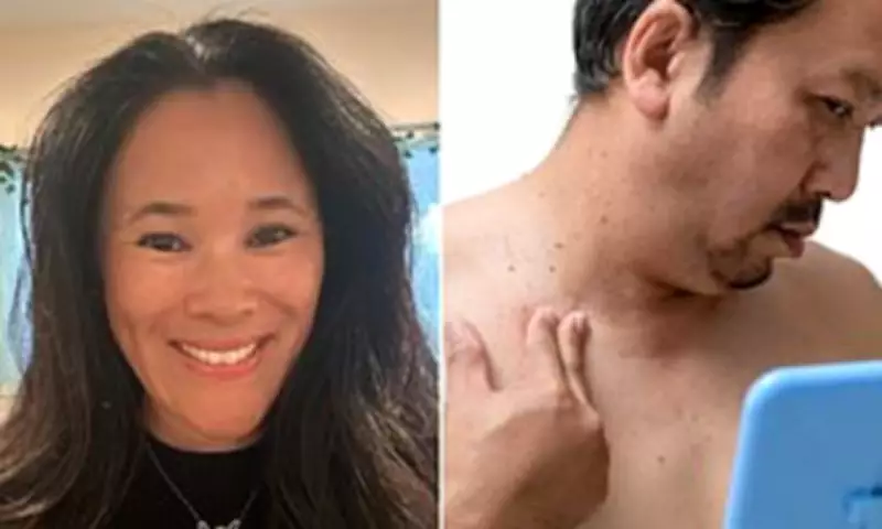 Skin Tags Could Signal Metabolic Disorders Like Diabetes and Liver Disease