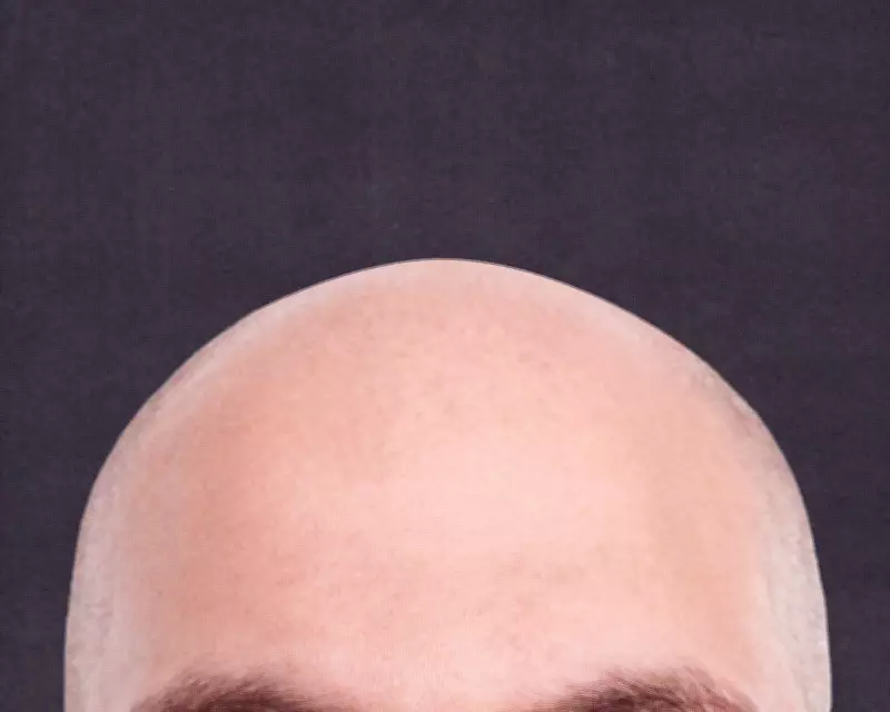 The r/bald Subreddit: A Beacon of Support in a Hair-Obsessed World