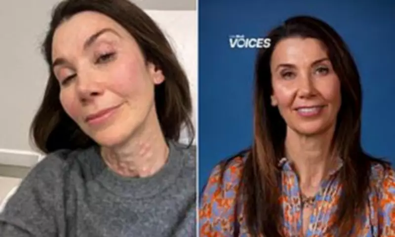 The Tweakment That Erased a Decade: How One Treatment Transformed My Skin